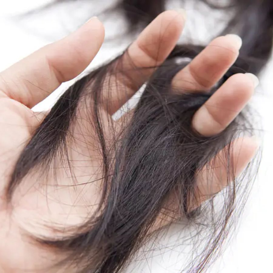 3 types of food that may cause hairloss dgtl