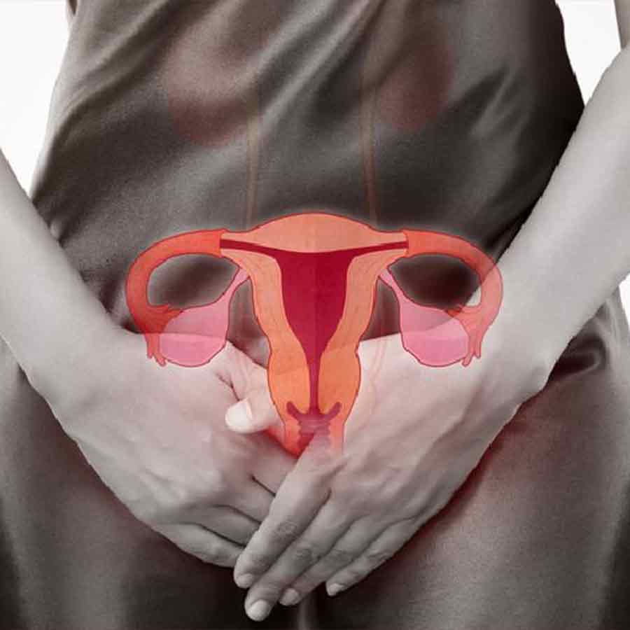 Cervical cancer is a growing concern in the country