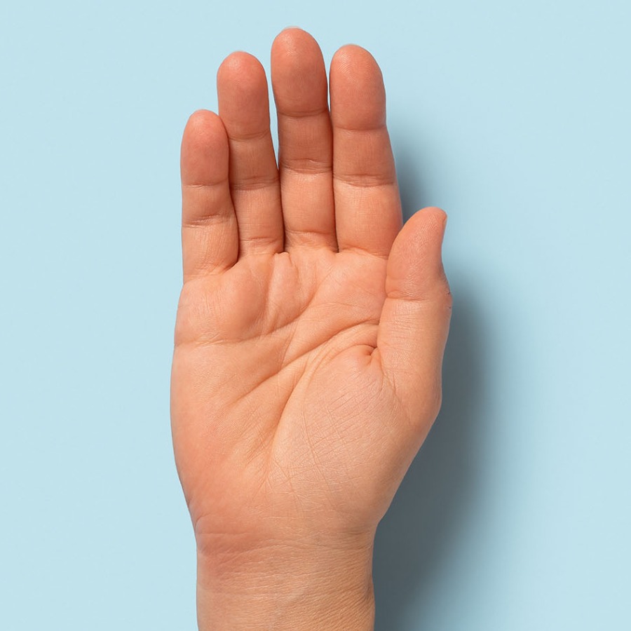 The condition of your palm can secretly reveal about your health dgtl