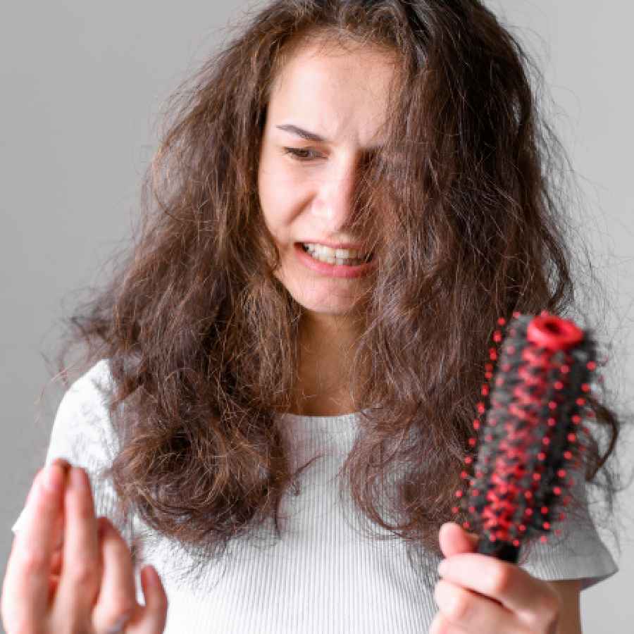 Can vitamin deficiency cause hair loss, how to improve it dgtl
