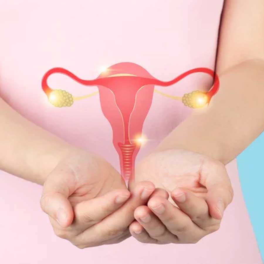 New study says PCOS showed over a 50 per cent slower response In women