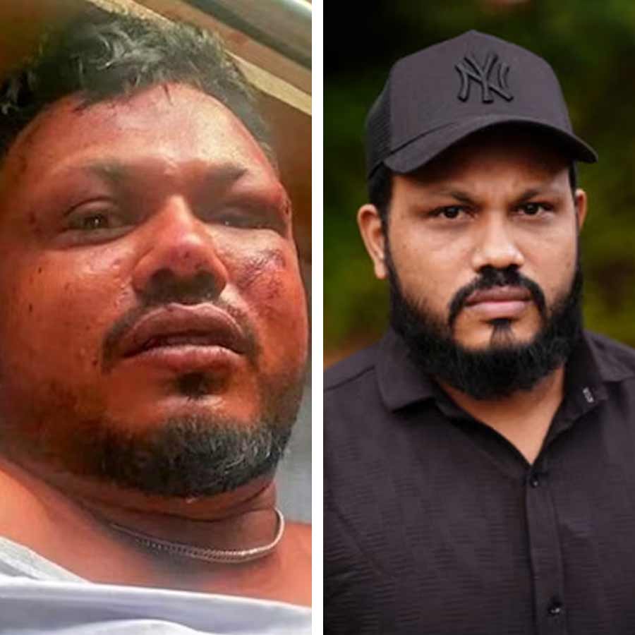 Lone Air India crash survivor\\\\\\\\\\\\\\\'s suffering from mental anguish