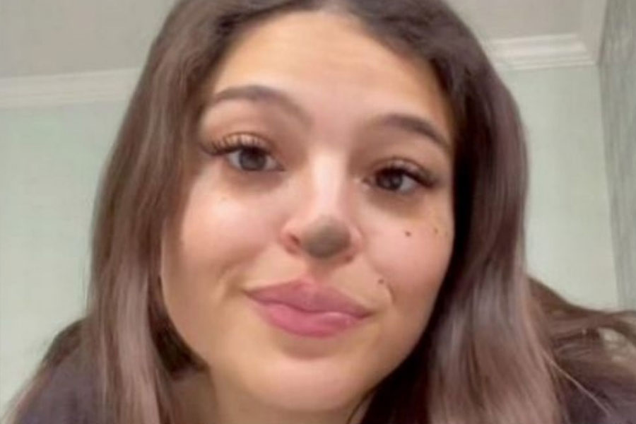 Birthmarks in many parts of our body and their hidden meaning