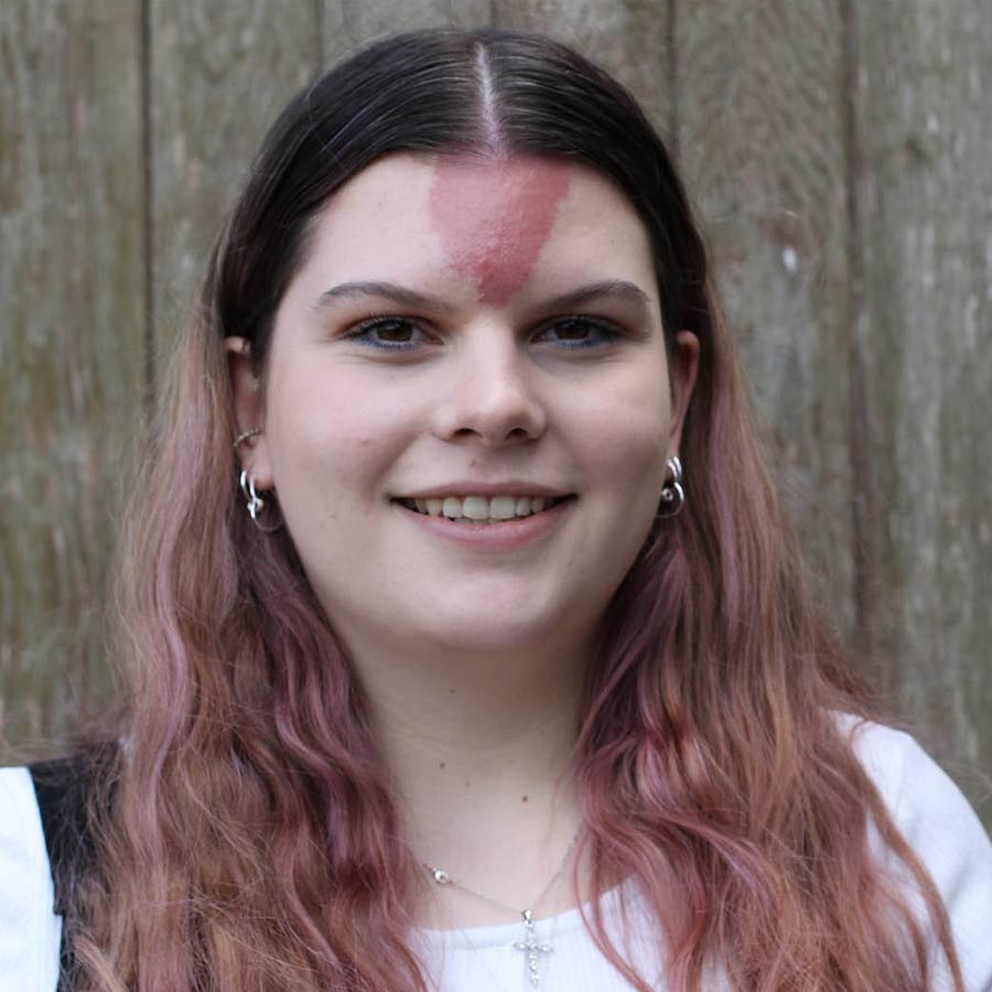 Birthmarks in many parts of our body and their hidden meaning