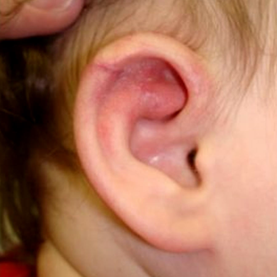 Birthmarks in many parts of our body and their hidden meaning