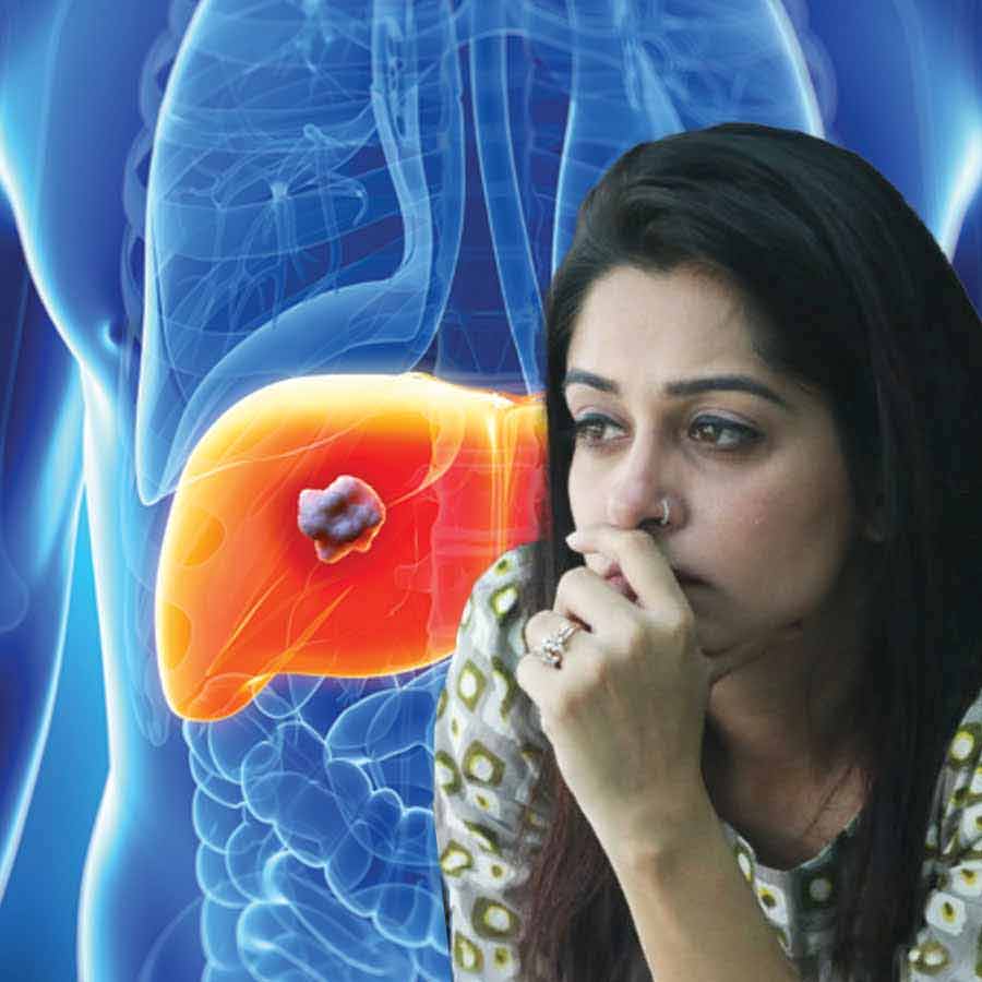 Dipika Kakar opens up about her cancer diagnosis what percentage of liver remove from her body