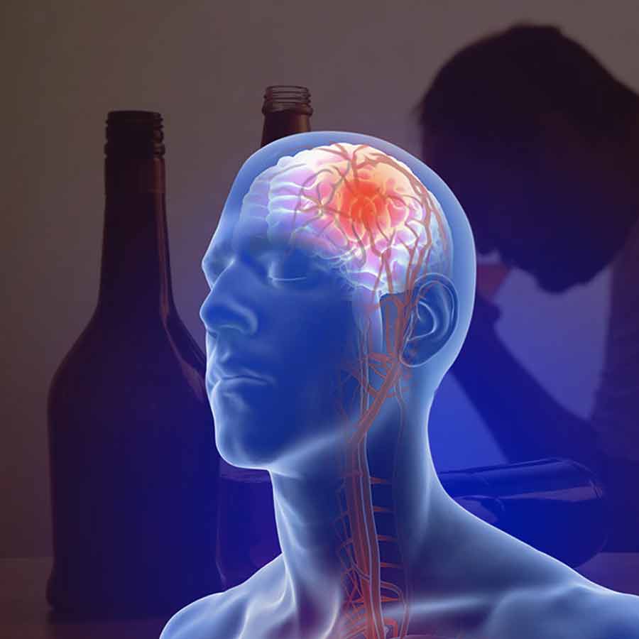 A new study has found that heavy alcohol use may cause Severe Brain Bleeds and sharply increasing stroke risk