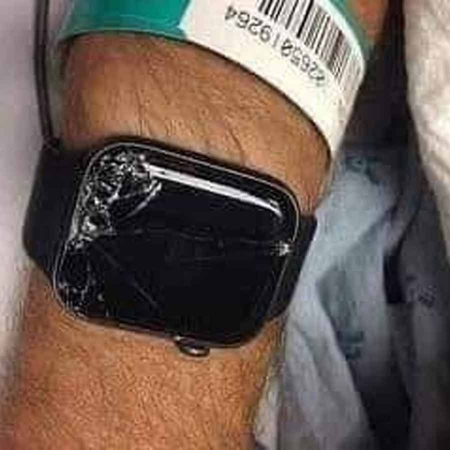 Apple Watch Saved Man’s Life After Serious Accident, Gave Alert to His Son dgtl