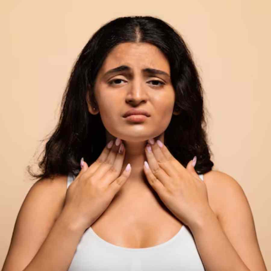 Here’s what you can do if you’re suffering from hoarseness dgtl