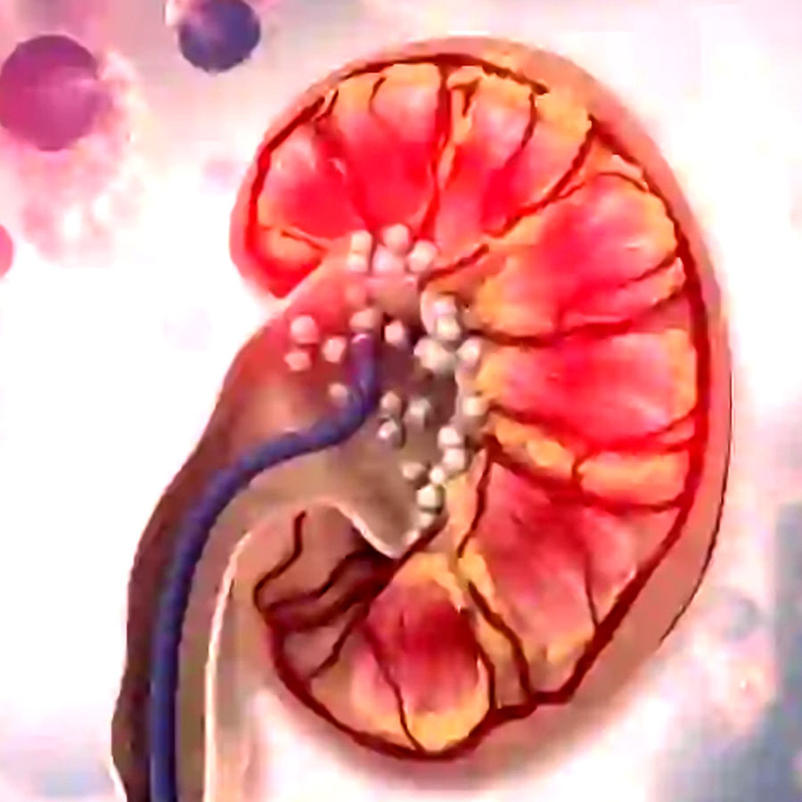 Scientists claim to have found a simple way to reverse kidney damage