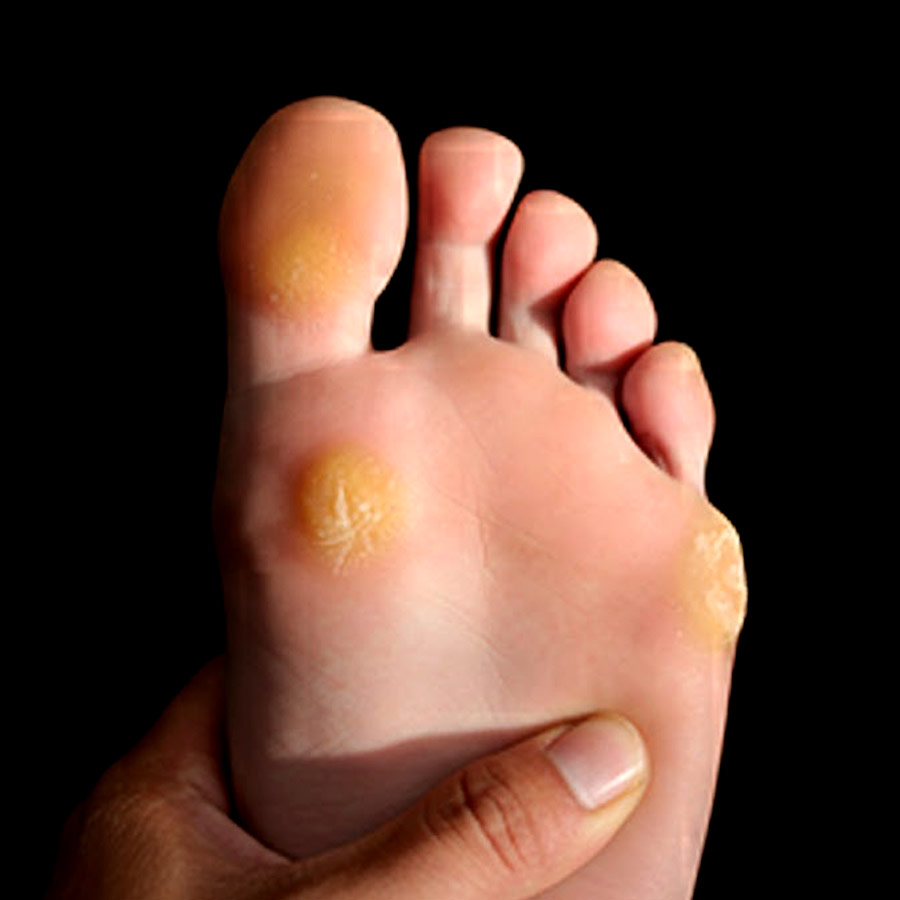 কড়াকে ছোট সমস্যা ভেবে অবহেলা করছেন না তো?