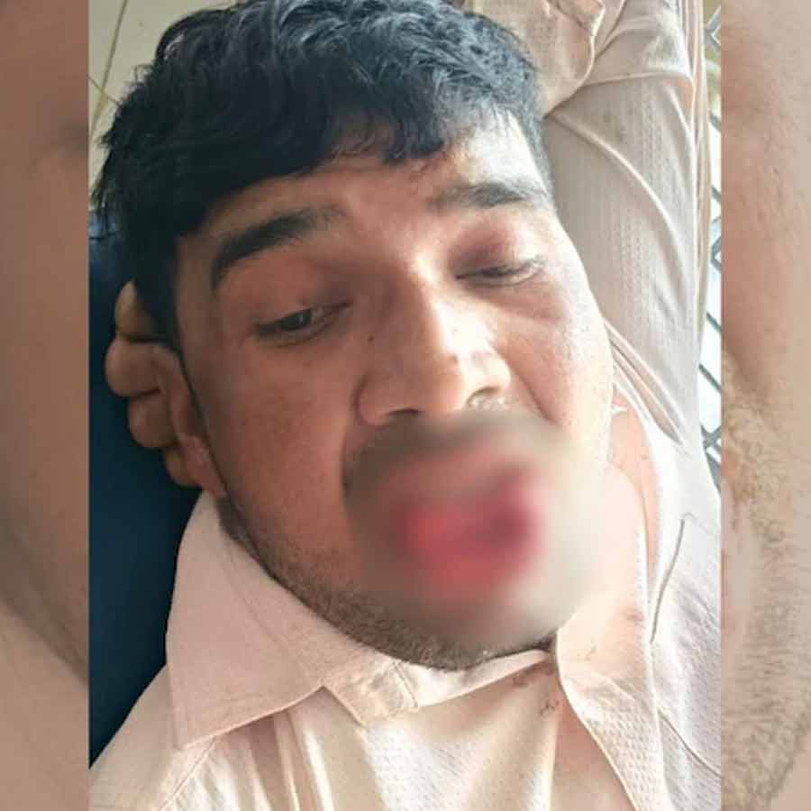 Woman attacked her ex-boyfriend while he allegedly tried to kiss her