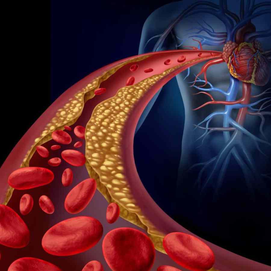 Know simple kitchen habits that may raise your cholesterol
