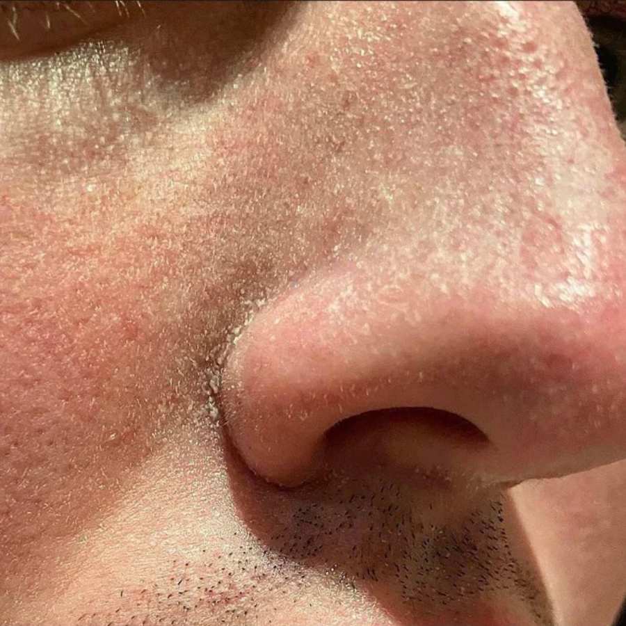 how to get rid of dead cell problem of skin in winter dgtl