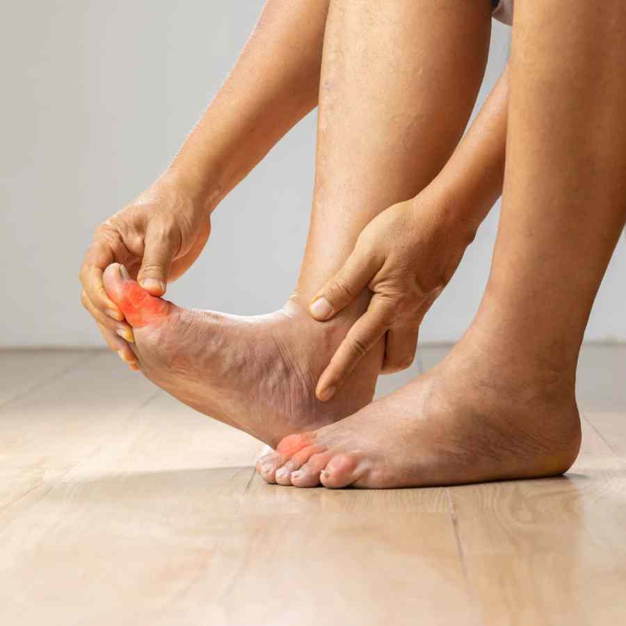 Best foods to reduce Uric Acid Level dgtl