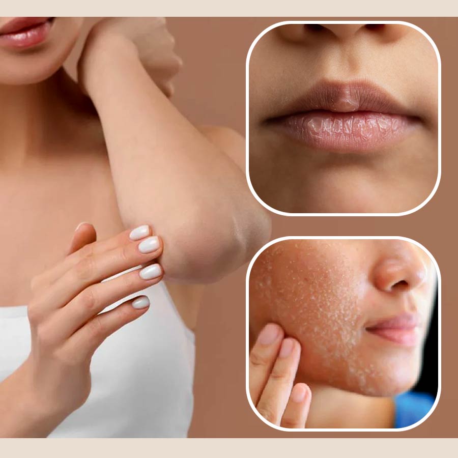 how to make moisturizing body lotion at home to combat winter dryness dgtl