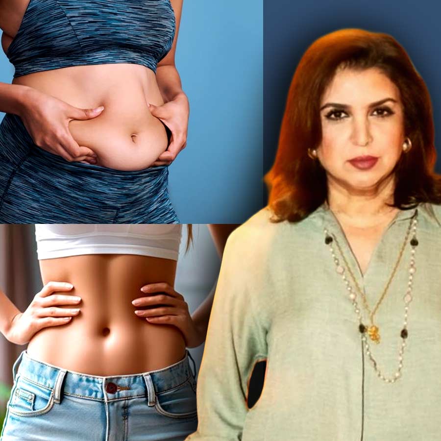 চর্বিহীন, টানটান পেটের চাহিদায় বিশেষ সার্জারি করান ফরাহ! কারা করাতে পারেন, কী কী উপকার