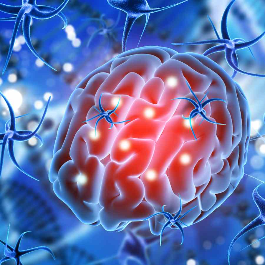 New Nasal drop could help fight deadly Brain Cancer Glioblastoma