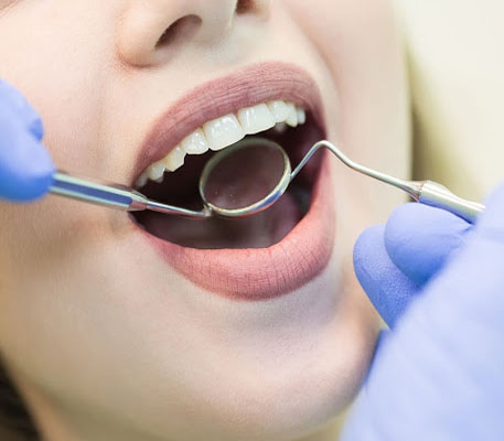 চেক-আপ: প্রয়োজন হলে দাঁতের চিকিৎসকের কাছে গিয়ে রুটিন চেক-আপ করিয়ে নিন। চিকিৎসক কোনও সম্ভাব্য সমস্যা (যেমন ক্যাভিটি বা মাড়ির রোগ) আগে থেকেই চিহ্নিত করতে পারবেন এবং প্রয়োজনীয় ব্যবস্থা নিতে পারবেন। যদি কোনও সমস্যা দেখা দেয়, তা হলে অবিলম্বে চিকিৎসকের পরামর্শ নিন।