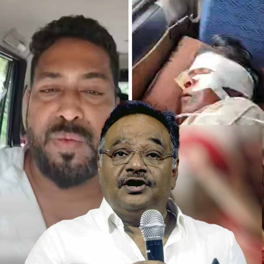 West Bengal BJP demands NIA probe regarding attack on BJP MP Khagen Murmu and MLA Shankar Ghosh dgtl