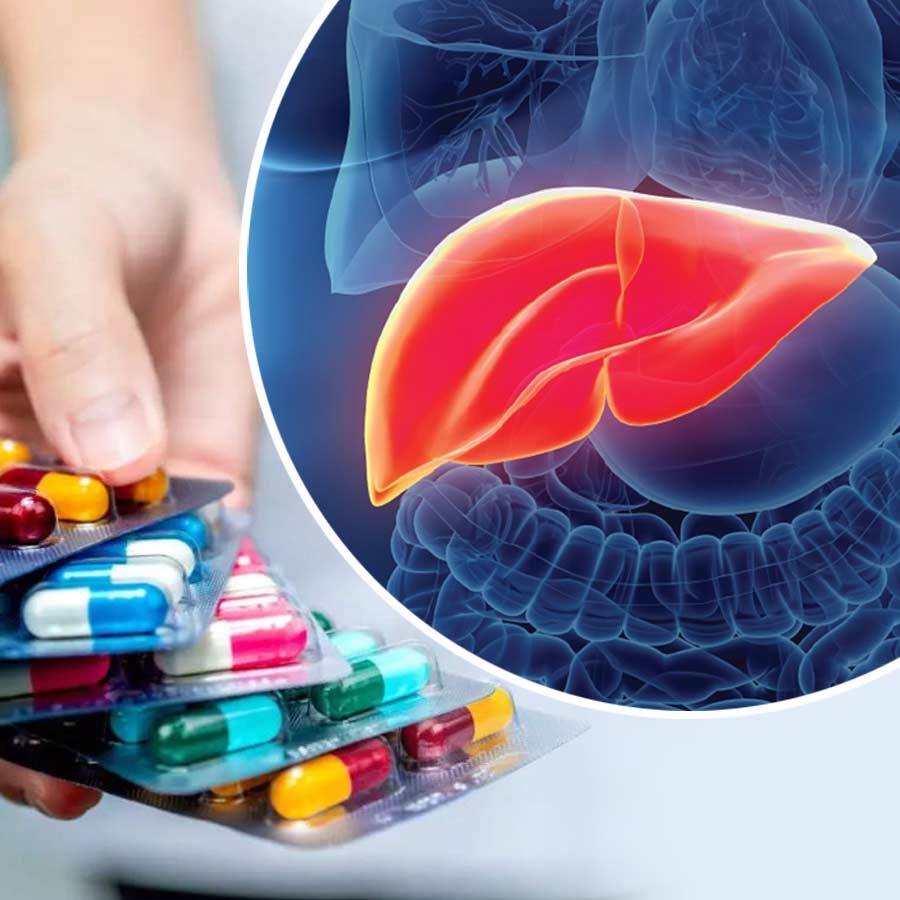 Scientists may have identified two medicines to treat Fatty Liver Disease