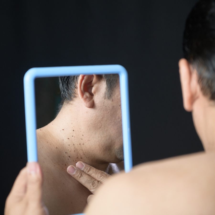 Five warning signs of diabetes that appear on your skin dgtl