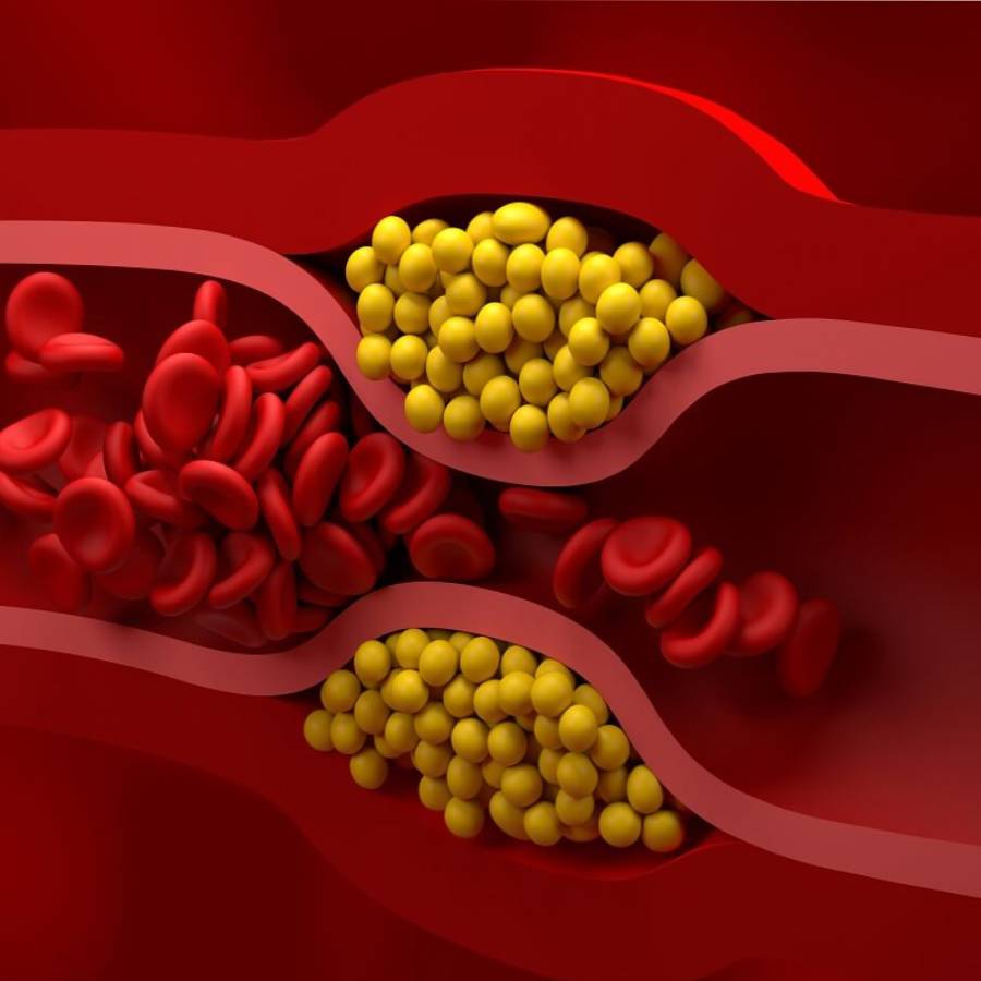 Some Food can bring down your cholesterol level, says nutritionists dgtl