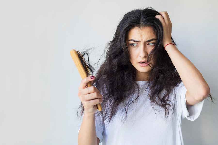 Why you may experience hair fall in festive season dgtl