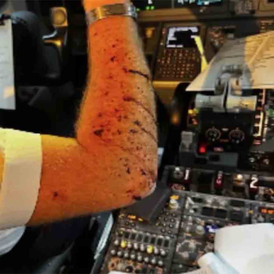 Boeing 737 flight takes 10,000 foot drop, pilot injured as windshield cracks midair dgtl