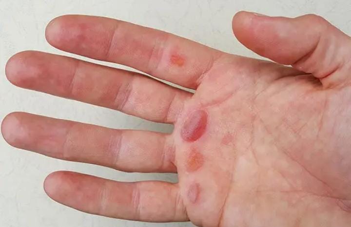 কোনও জায়গার সঙ্গে যেন ধাক্কা না লাগে, সেই দিকে নজর রাখা প্রয়োজন। 