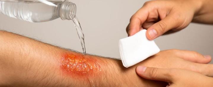  প্রথমেই জল দিয়ে আগুন নেভানোর চেষ্টা করুন। জল হাতের সামনে আর না পেলে ভারী কম্বল বা ভারী কাপড় জড়িয়ে নেভান। 