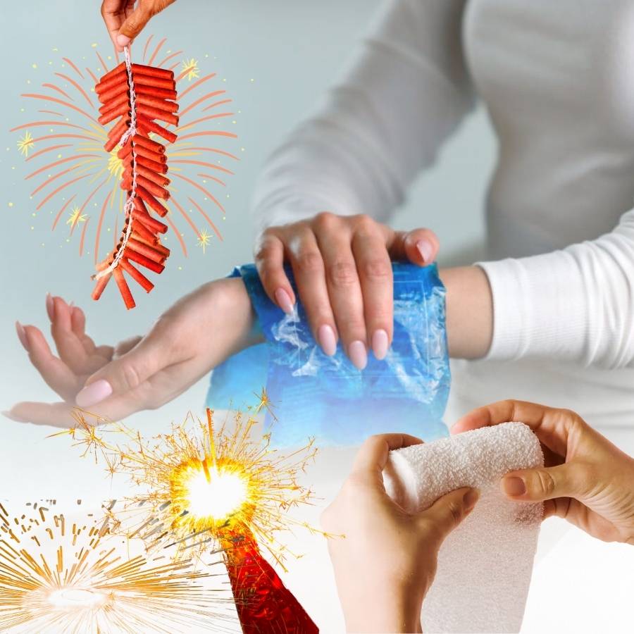 How to Provide Primary Treatment for Firecracker Related Burn dgtl