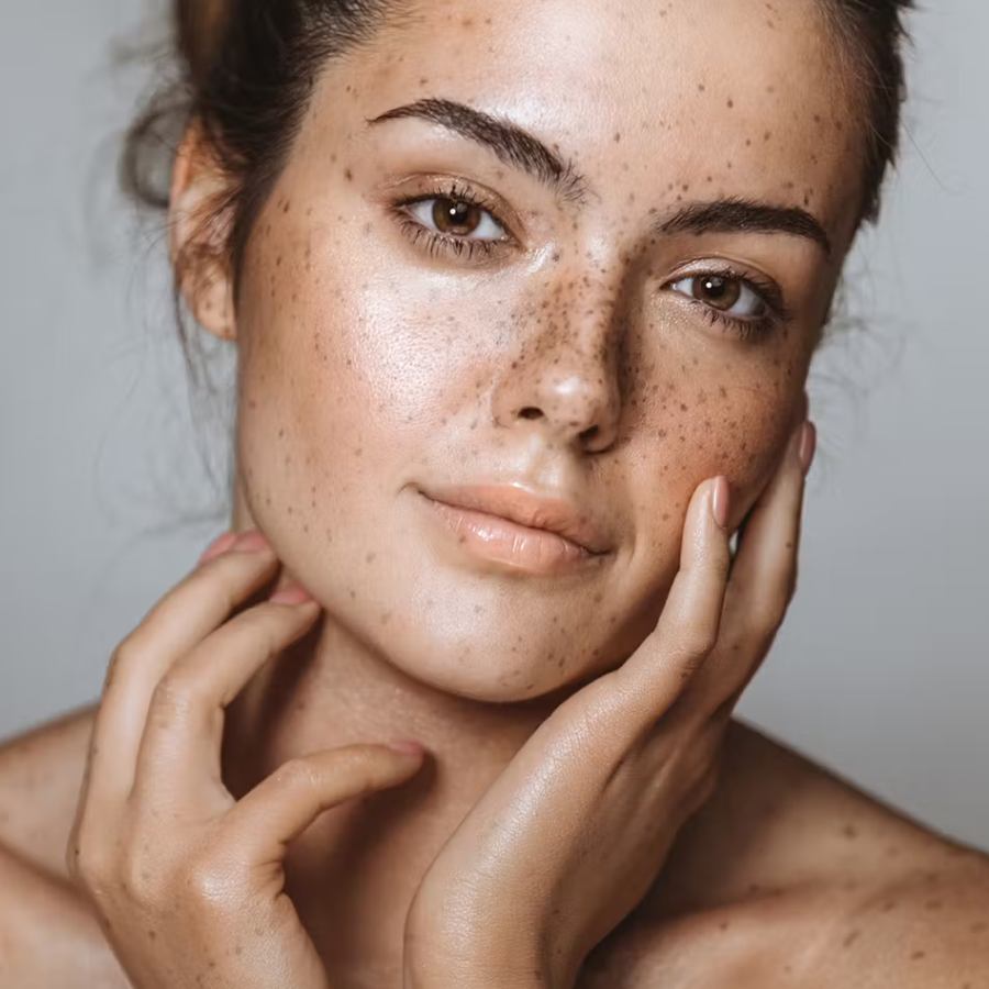 A drink with just two ingredients can help you get rid of even 10 years ol pigmentation says expert dgtl