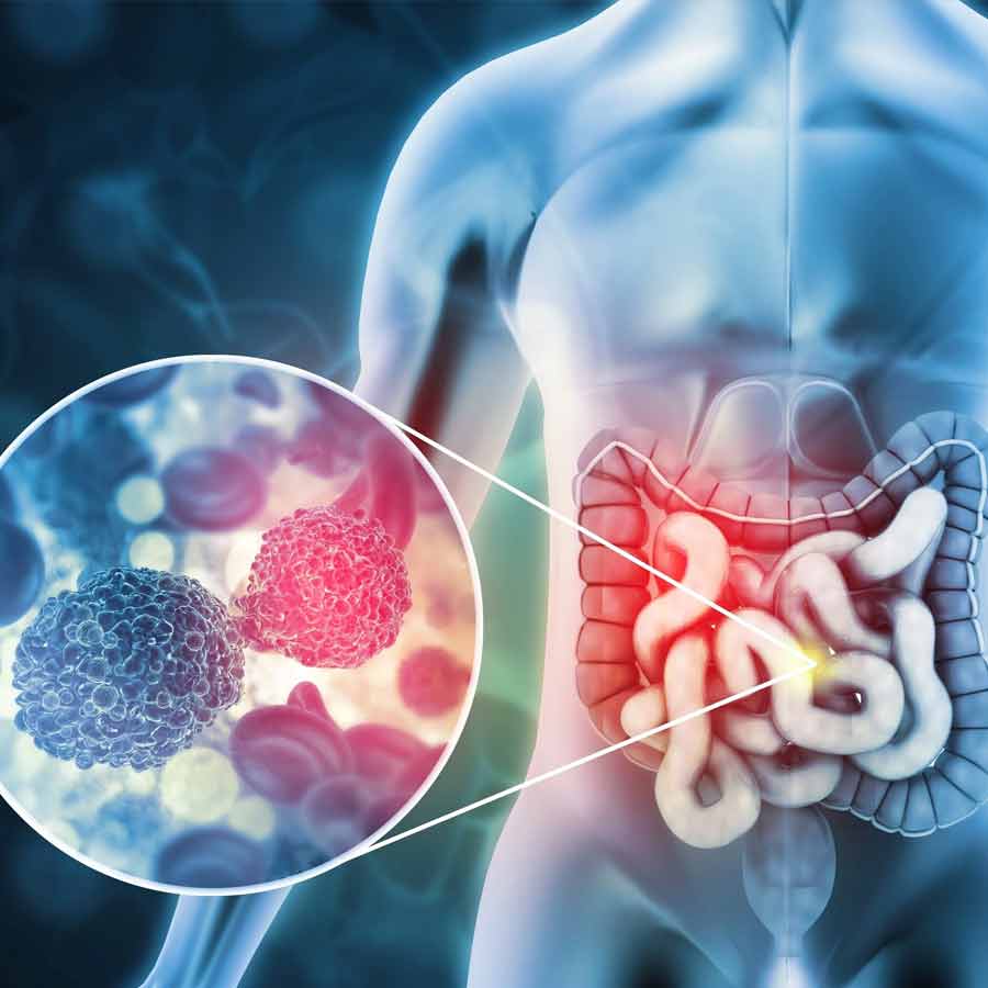 3 popular fruits that can reduce risk of colon cancer