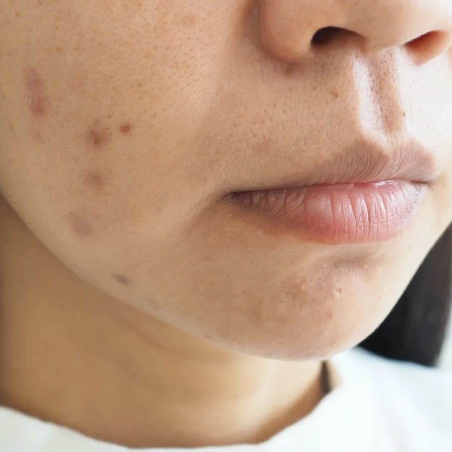 কিন্তু এর প্রতিকার কী? কেমন ভাবেই বা মিলবে সমস্যার সমাধান।