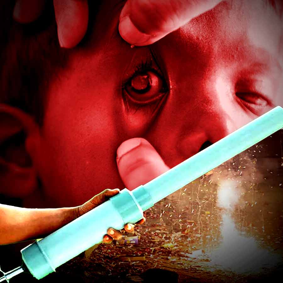 14 Children in Madhya Pradesh Suffer Vision Loss After Playing With ‘Carbide Gun’ During Diwali dgtl