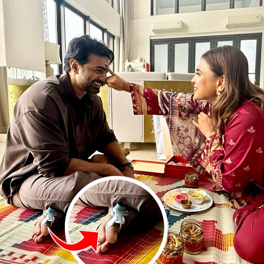 Fans got tensed as they noticed some cap on actor Dev’s leg dgtl