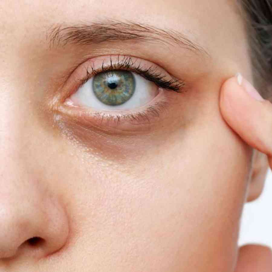 উৎসবের দিন মানেই রাত জেগে ঠাকুর দেখা, নইলে বাড়ি বসিয়ে জমিয়ে আড্ডা। খাওয়া দাওয়ায় অনিয়ম, স্লিপ সাইকেল ঘেঁটে যাওয়া, ইত্যাদি। আর তার পরিণাম আমাদের চেহারা, চুলে ফুটে ওঠে। কম ঘুমের কারণে উৎসবের পর অনেকেরই চোখের তলায় কালি পড়তে দেখা যায় এটিকে দূর করুন ঘরোয়া উপায়ে। 