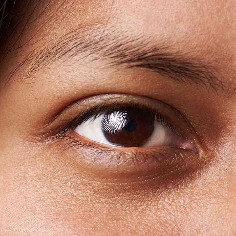 চোখের তলার কালি বা ডার্ক সার্কেল দূর করতে পার্লার বা দামী জিনিস কিনতে হবে না। বরং রান্নাঘরে সহজলভ্য এই উপাদানকেই বেছে নিন। 