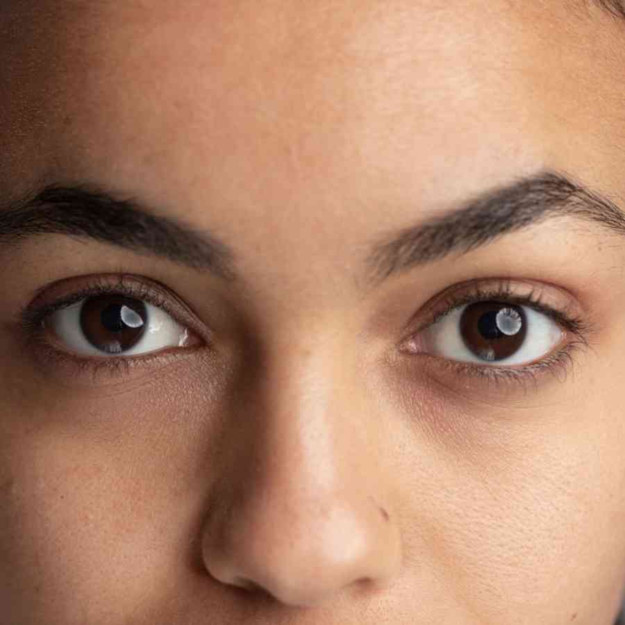 Get Rid Off Dark Circles by Using Potatoes dgtl