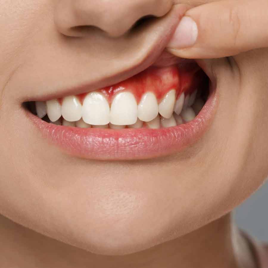 New research reveals that poor oral hygiene and gum disease may dramatically raise the risk of Brain stroke