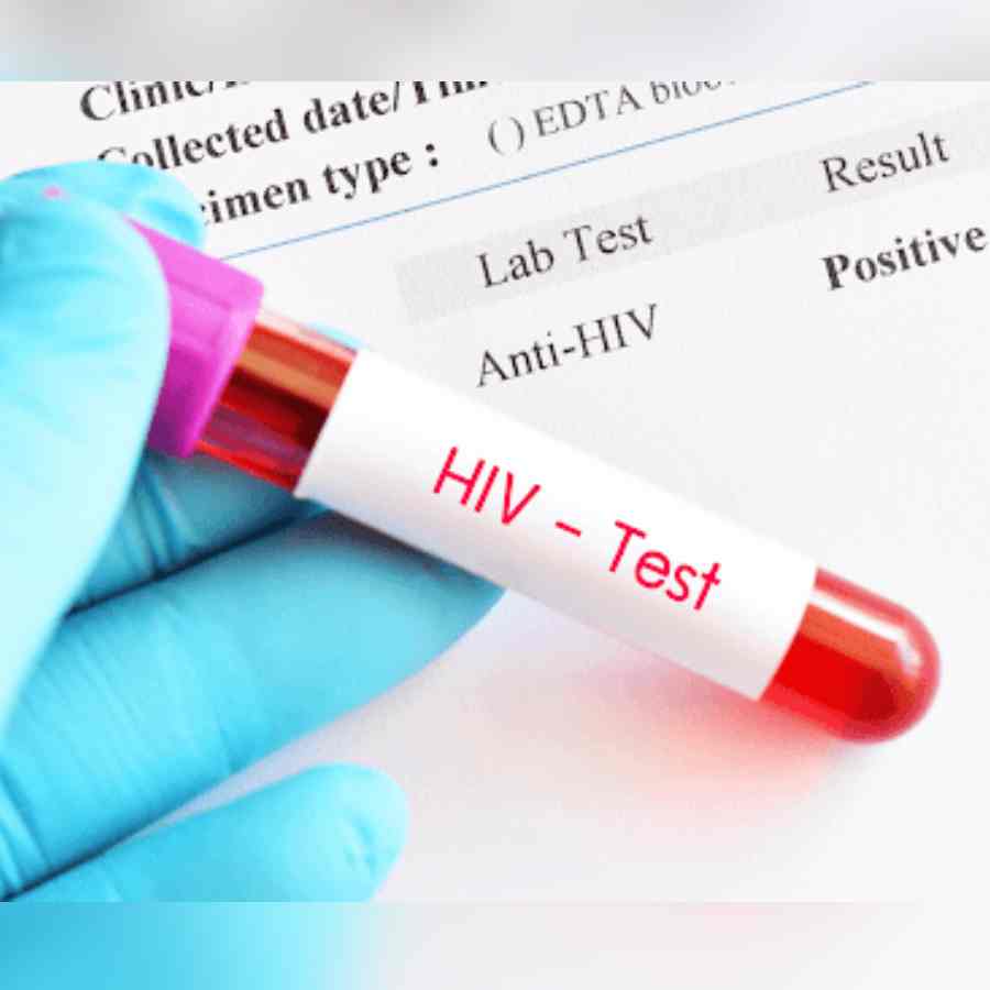 Jharkhand: Child tests HIV-positive; Probe team from Ranchi inspects Chaibasa blood bank dgtl