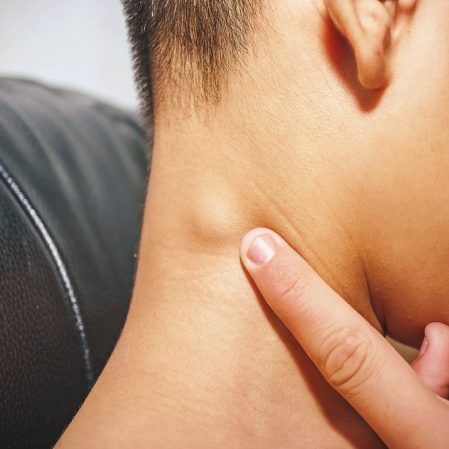 How to differentiate between cyst and tumour, identify the harmless and harmful lump dgtl