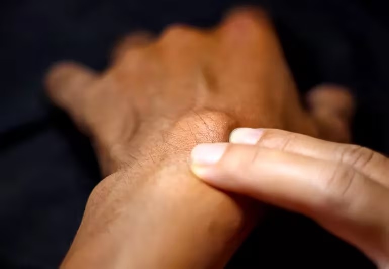 কোন স্ফীতি কোন প্রকৃতির, কী ভাবে বুঝবেন?