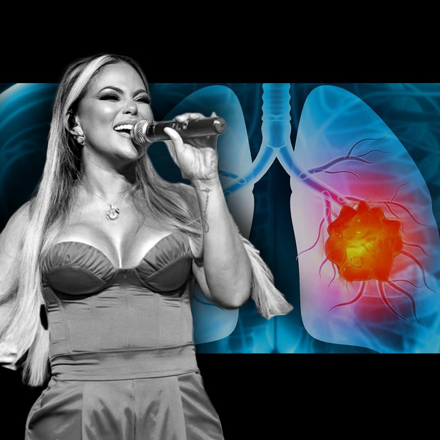 Brazilian singer dies from rare lung cancer, everything to know about this rare disease