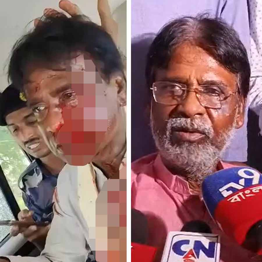 Khagen Murmu Injured