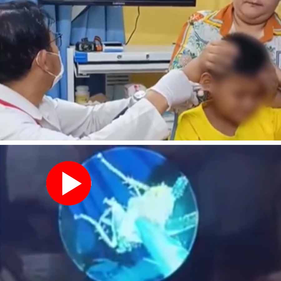 Jinsiy olatni sorayotgan erkak surati