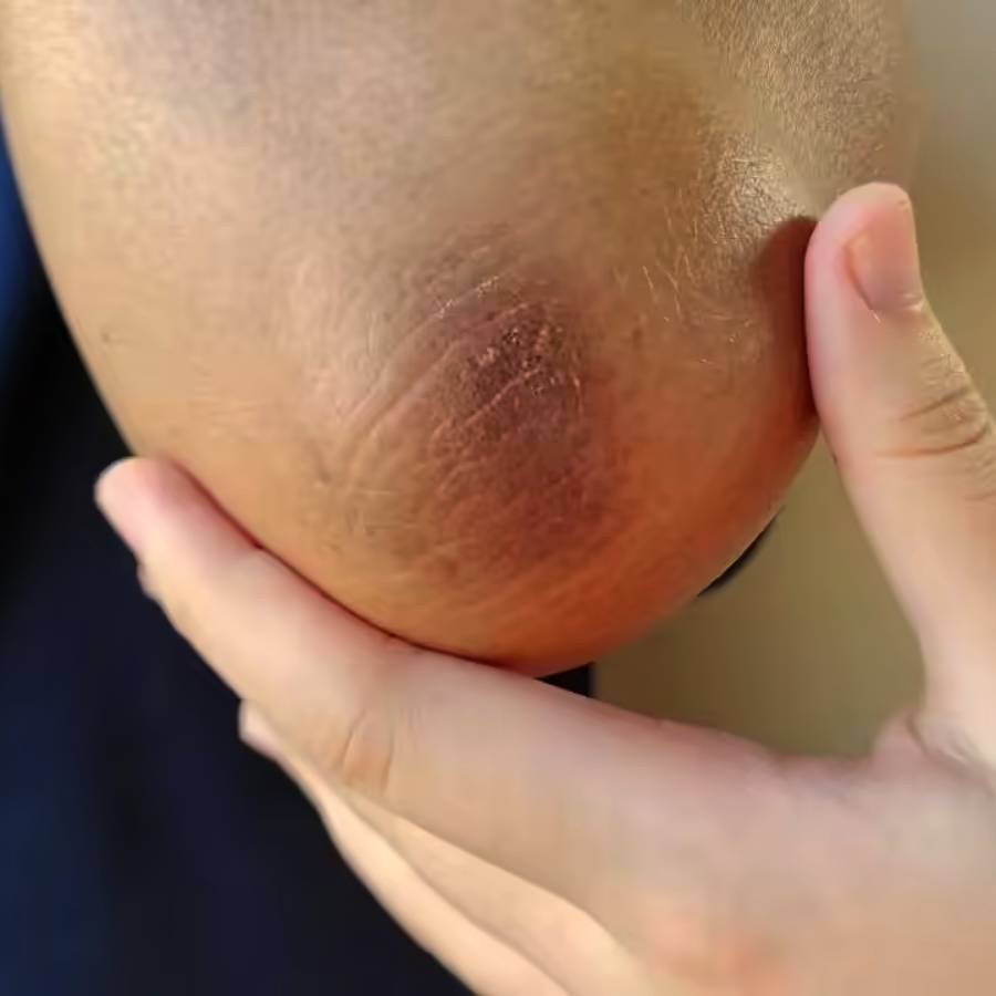 how to scrub the black spot out of your elbow dgtl