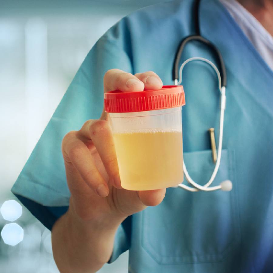 প্রস্রাবের সঙ্গে ফেনা তৈরি হলে কি ভয়ের কোনও কারণ আছে?