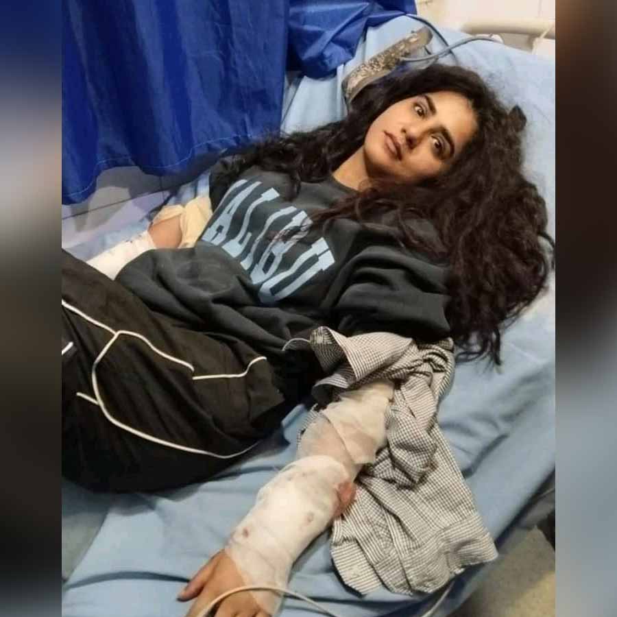 ক্ষত-বিক্ষত গায়িকা।